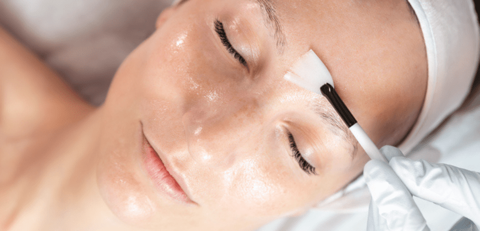 Obagi chemical peel being applied in Sydenham clinic